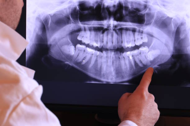 Best Emergency Dental Care for Sports Injuries in Springfield, KY